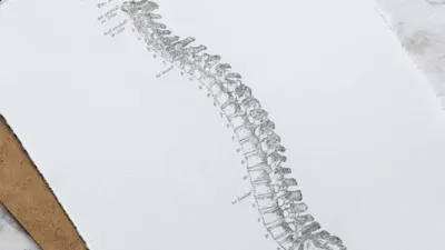 Massage therapy supporting neck and spine recovery after whiplash.